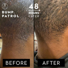 Charger l'image dans la galerie, Formule après-rasage Bump Patrol Force maximale - Solution après-rasage qui élimine les bosses du rasoir et les poils incarnés - 2 oz