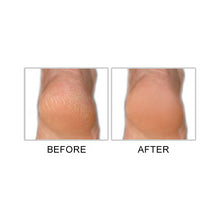 Charger l'image dans la galerie, M. Pumice Callus Terminator, 4 onces liquides