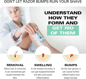 Bump Patrol For Her - Calm & Hydrating Aftershave for Women - Razor Bumps, Razor Burn, and Ingrown Hair Treatment for Bikini Area, Underarms, and Legs - 4oz