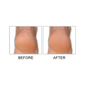 M. Pumice Callus Terminator, 4 onces liquides